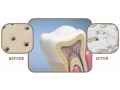 WhiteWash Nano Tooth Sensitivity Serum Kit
